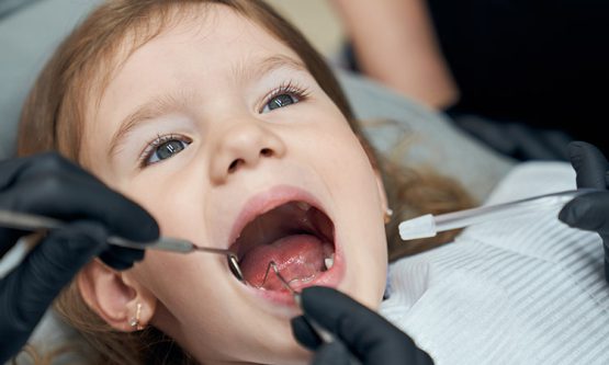 عصب کشی یا پالپوتومی دندان کودکان